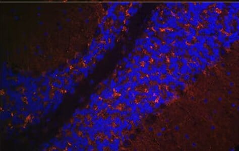IHC of mouse brain using Anti-VGLUT2 Antibody (A90888)