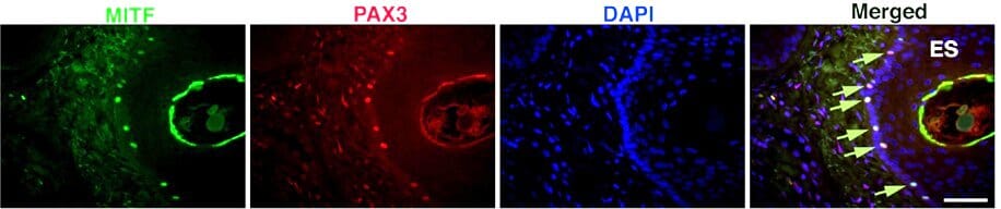Immunofluorescence of Melanocye Transcription Factors