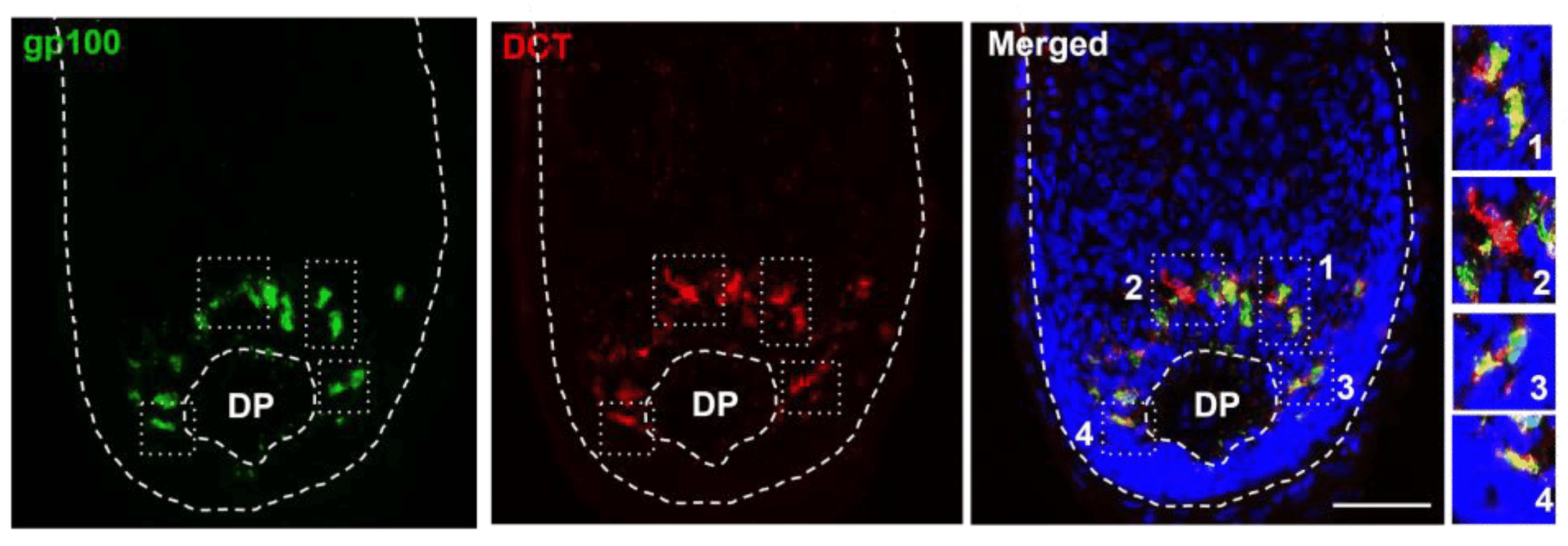 Immunofluorescence of gp100 and DCT expression in human scalp