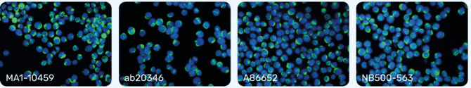 Immunocytochemistry of K562 cells using Anti-Vimentin Antibody (MA1-10459) from Thermo Fisher, Anti-Vimentin Antibody (ab20346) from Abcam, Anti-Vimentin Antibody (A86652) from Antibodies.com, and Anti-Vimentin Antibody (NB500-563) from Novus Biologicals. Nuclei counterstained with DAPI.