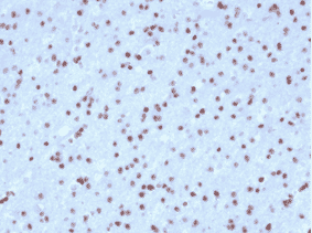 Immunohistochemistry - Anti-OLIG2 Antibody [OLIG2/2400] (A248077) - Antibodies.com