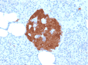 Immunohistochemistry - Recombinant Anti-PGP9.5 Antibody [rUCHL1/775] (A250275) - Antibodies.com