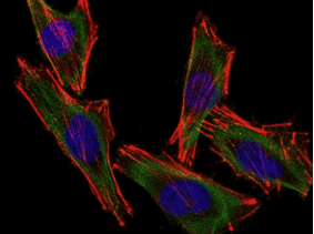 Immunofluorescence - Anti-S100 beta Antibody (CF® 488) [S100B/1012] (A251210) - Antibodies.com