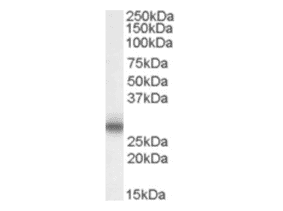 Western Blot - Anti-MPZ Antibody (A83515) - Antibodies.com