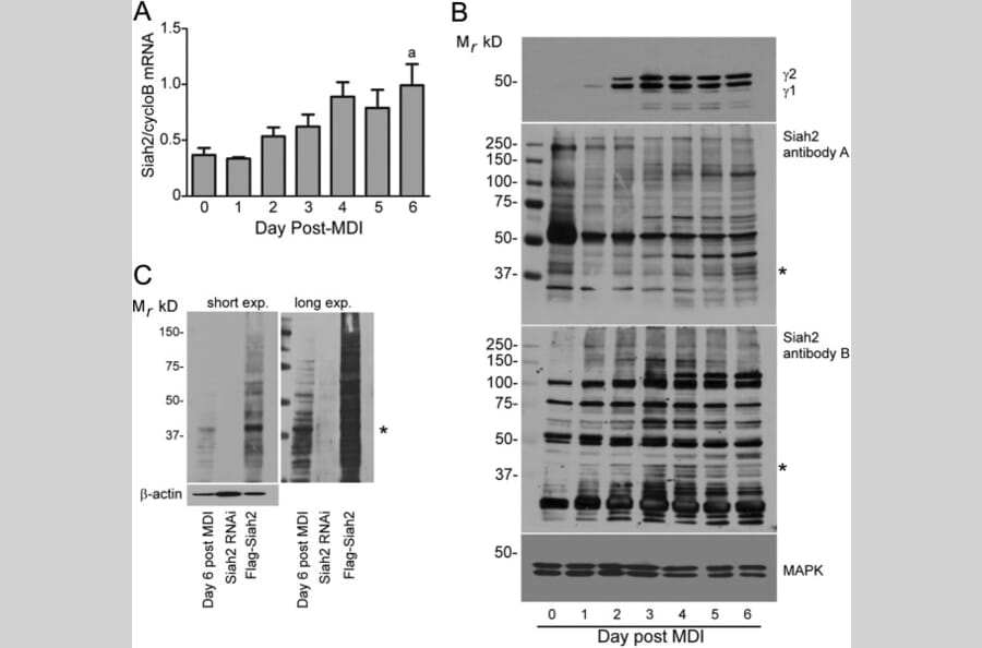 Anti-Siah-2 (E266) Antibody (A26265) | Antibodies.com