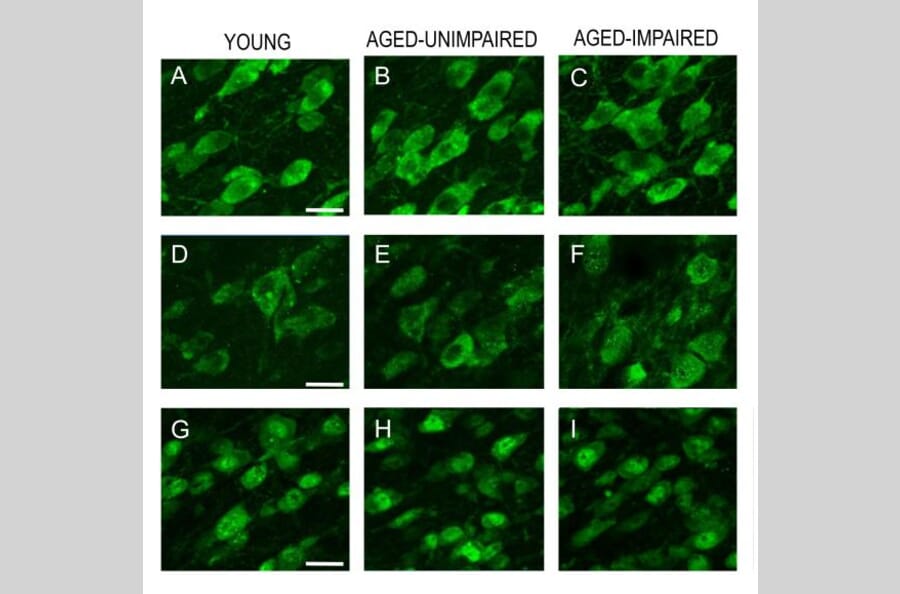 AntiGAD67 (A492) Antibody (A25164)