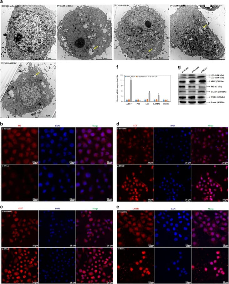 AntiITGB1 Antibody (A17015)