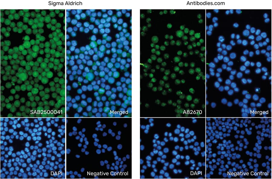 Immunofluorescence - Anti-AIF1 Antibody (A82670) from Antibodies.com vs Anti-AIF1 Antibody (SAB2500041) from Sigma Aldrich