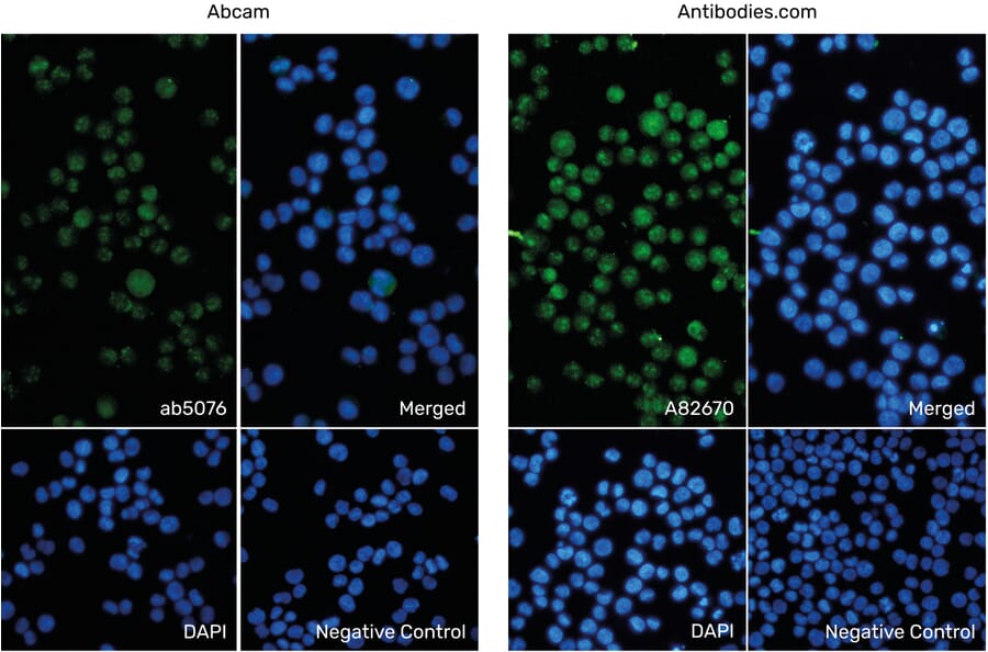 Immunofluorescence - Anti-AIF1 Antibody (ab5076) from Abcam vs Anti-AIF1 Antibody (A82670) from Antibodies.com