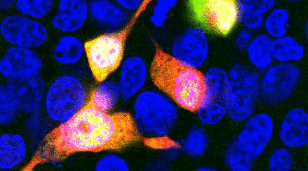 Immunofluorescence - Antibodies.com