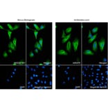 Immunofluorescence - Anti-GFAP Antibody (A85419) from Antibodies.com vs Anti-GFAP Antibody (NB300-141) from Novus Biologicals