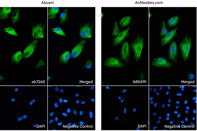 Immunofluorescence - Anti-GFAP Antibody (ab7260) from Abcam vs Anti-GFAP Antibody (A85419) from Antibodies.com