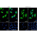 Immunofluorescence - Anti-GFAP Antibody (ab7260) from Abcam vs Anti-GFAP Antibody (A85419) from Antibodies.com