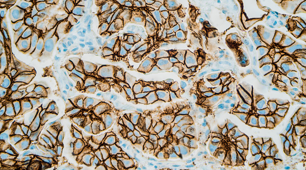 Western Blot - Antibodies.com