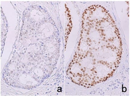 Effects of different HIER buffers on IHC outcome - 2 panel image depicting chromogenic IHC