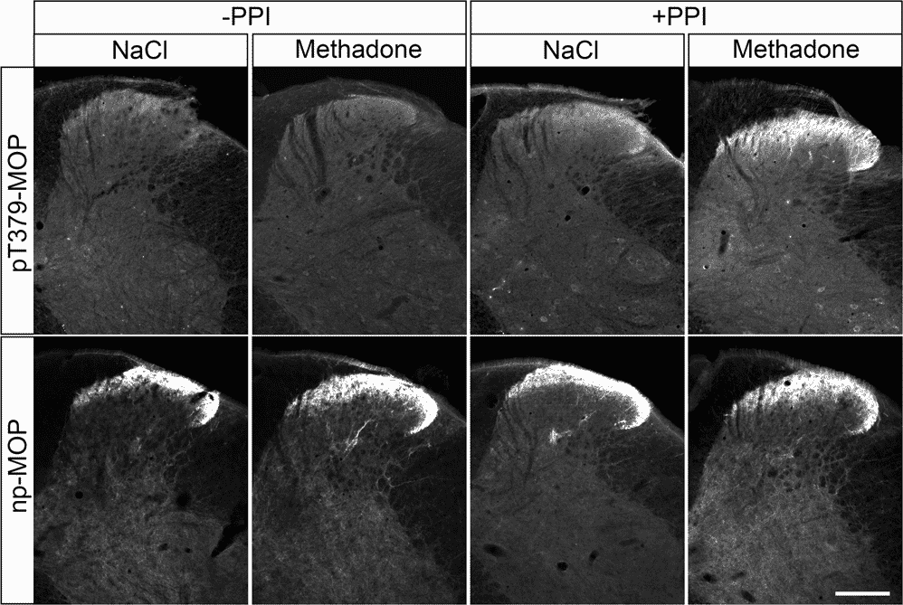 IHC dilution series - Two rows of images depicting fluorescent IHC using a CCK-8 antibody at 1:1k, 1:4k, 1:8k and 1:16k