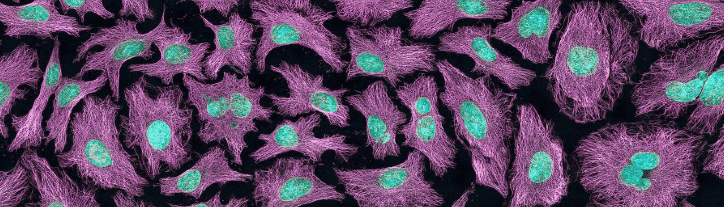 Immunocytochemistry - HeLa Cell Staining - Antibodies.com