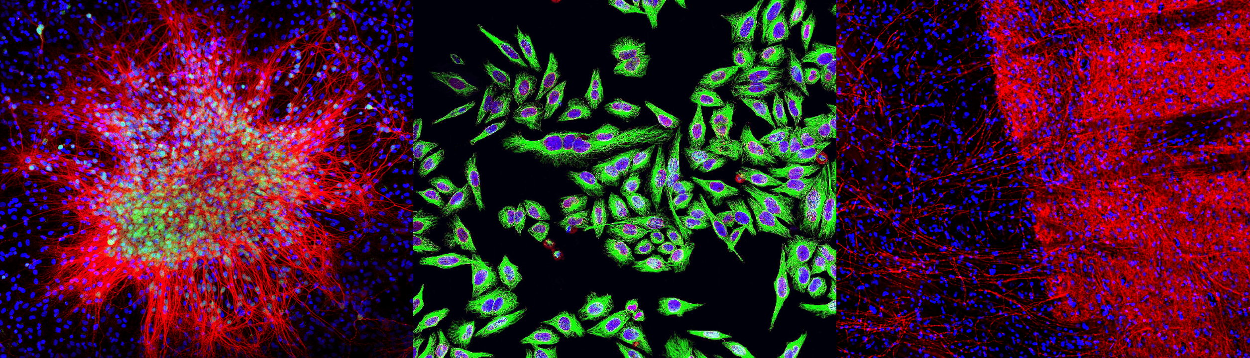 Immunocytochemistry/Immunofluorescence - Staining Examples - Customer Images - Antibodies.com