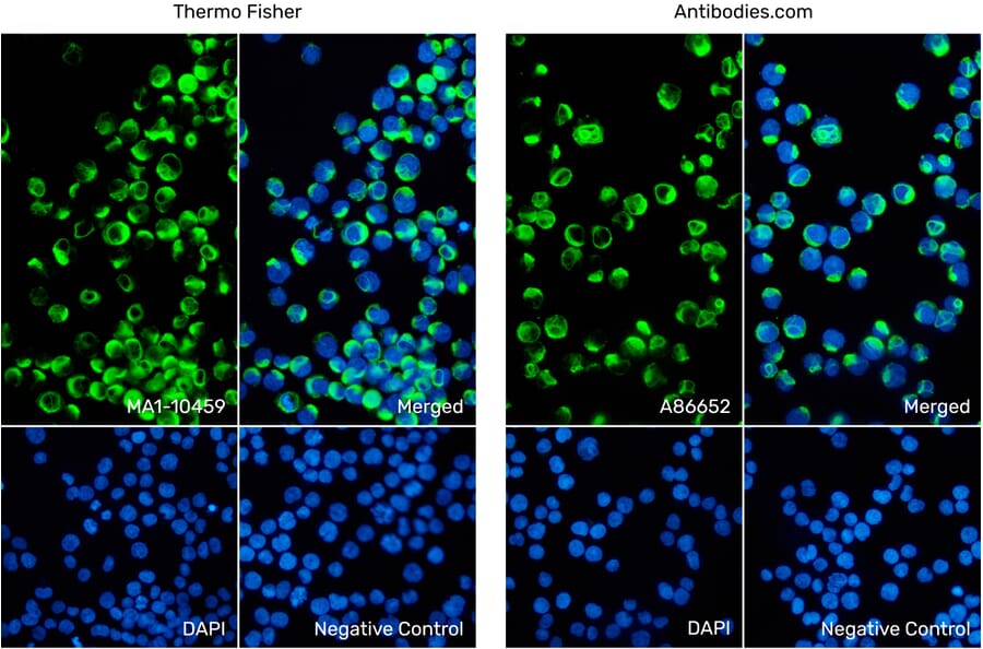 Immunofluorescence - Anti-Vimentin Antibody [VI-10] (A86652) from Antibodies.com vs Anti-Vimentin Antibody [VI-10] (MA1-10459) from Thermo Fisher