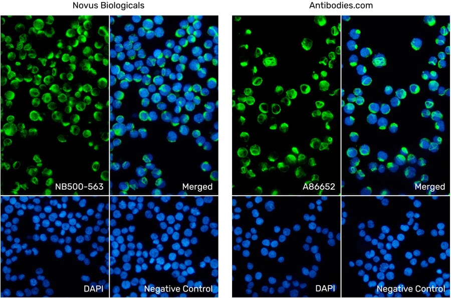 Immunofluorescence - Anti-Vimentin Antibody [VI-10] (A86652) from Antibodies.com vs Anti-Vimentin Antibody [VI-10] (NB500-563) from Novus Biologicals