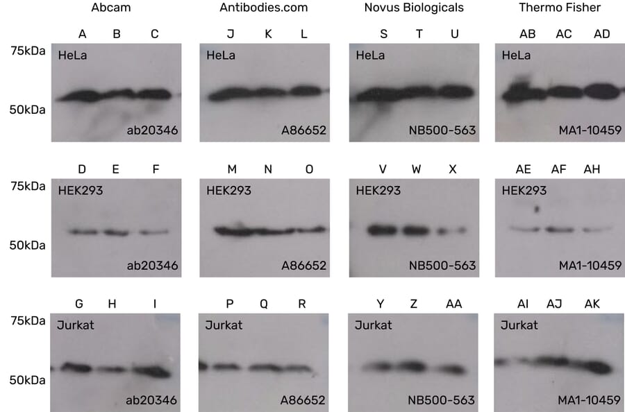 Western Blot - Anti-Vimentin Antibody [VI-10] (ab20346) from Abcam vs Anti-Vimentin Antibody [VI-10] (A86652) from Antibodies.com vs Anti-Vimentin Antibody [VI-10] (NB500-563) from Novus Biologicals vs Anti-Vimentin Antibody [VI-10] (MA1-10459) from Thermo Fisher