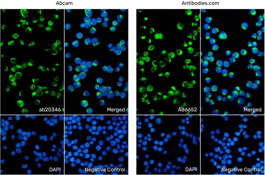 Immunofluorescence - Anti-Vimentin Antibody [VI-10] (ab20346) from Abcam vs Anti-Vimentin Antibody [VI-10] (A86652) from Antibodies.com