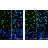 Immunofluorescence - Anti-Vimentin Antibody [VI-10] (ab20346) from Abcam vs Anti-Vimentin Antibody [VI-10] (A86652) from Antibodies.com