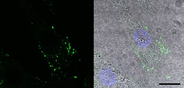 Fluorescently labeled exosome-based nanoparticles in cell culture