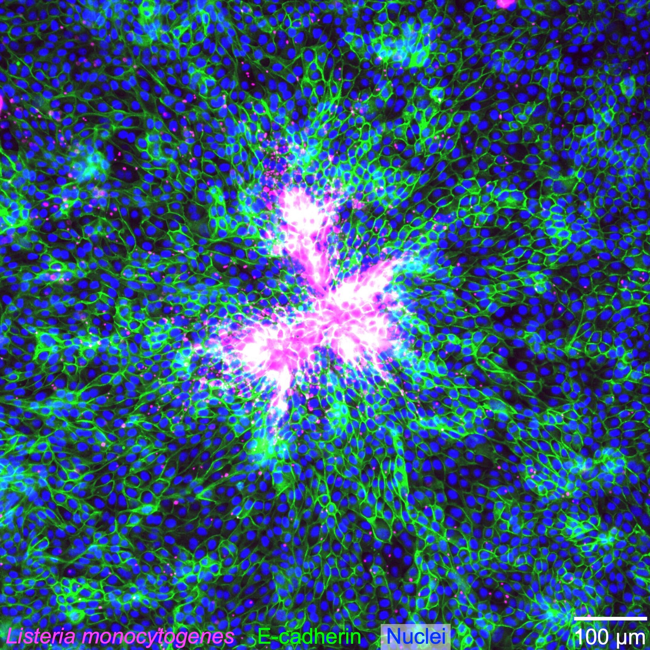 Fluorescently labeled Listeria monocytogenes and epithelial MDCK cells