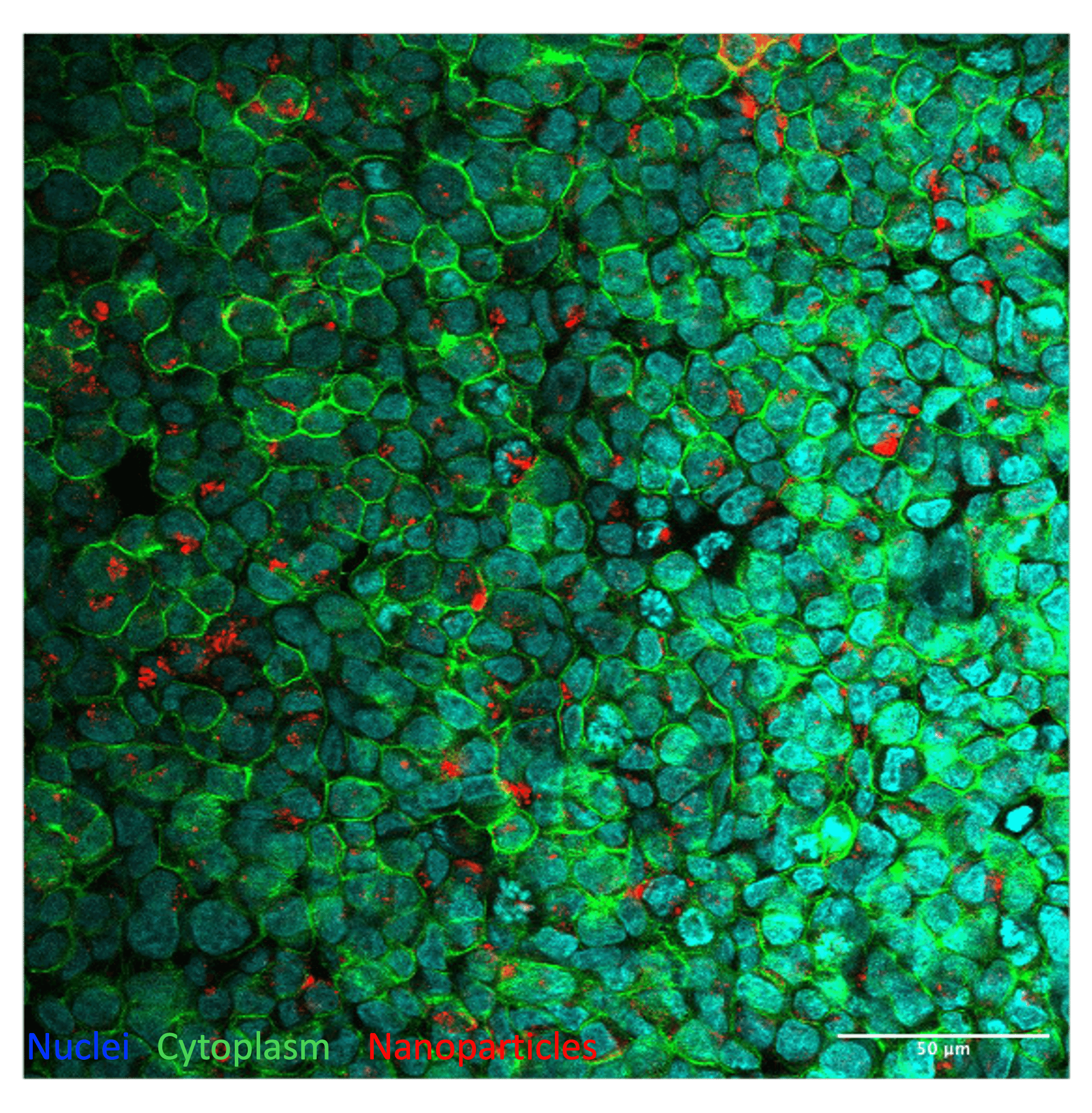 Fluorescence microscopy of nanoparticle uptake by colorectal cancer cells.