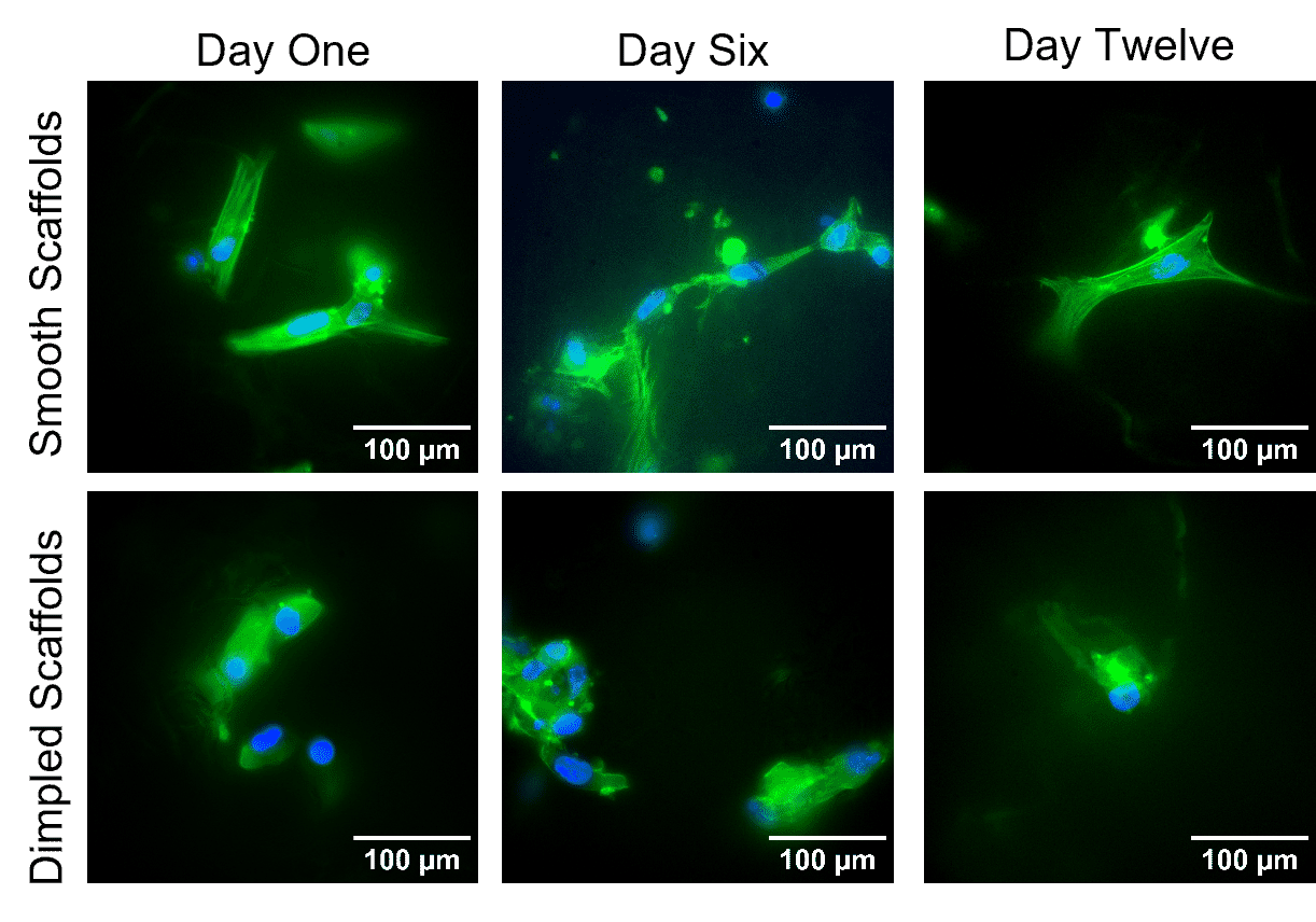 Immunofluorescence staining of HUASMC - Andrew Johnston, University of Edinburgh